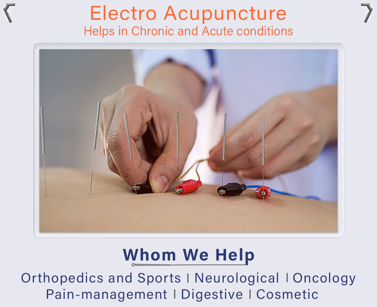 Electro Acupuncture Helps in Chronic and Acute pain - Neuropathy, Cancer Pain, Rheumatoid Arthrities. RELIEVING PAIN WITH ACUPUNCTURE
